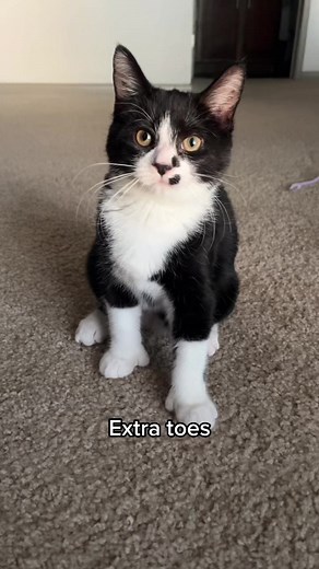 Extra Toes: Unique Human Traits Explored