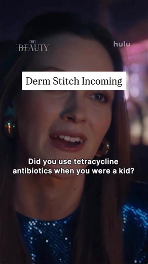Both Minocycline and Tetracycline induced hyperpigmentation is a thing. It is more common with minocycline than tetracycline. The prevalence of teeth staining is 3-6% and the risk is more with long term use, like years. Minocycline cannot only cause discoloration of the teeth but also pigment at spots of previous scarring or inflammation, in chronically sun exposed areas or on the shins. Pigment is more likely with long treatment courses. The pigment often fades but long term treatment with thes