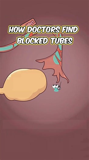 How doctors find blocked tubes