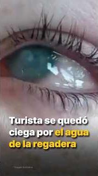 Turista se quedó ciega por el agua de la regadera