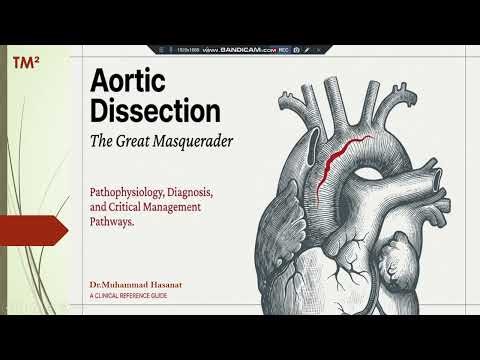 Aortic Dissection l Clinical Guide