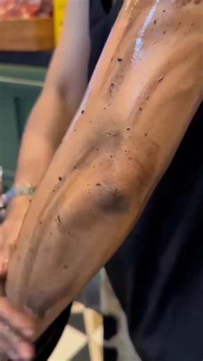 Dark Elbow Cleaning Tips | Remove Dead Skin & Tanning | #shorts