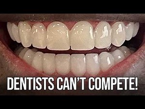 Perfect 7 Day Smile Makeovers for Less than $1,000 by Brighter Image Lab