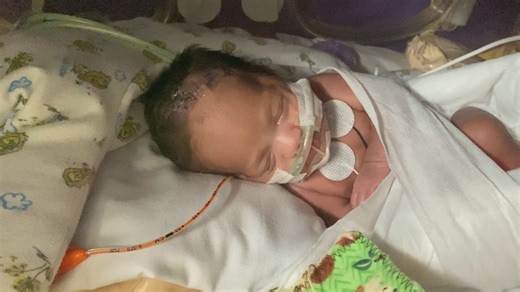 'She's barely over a pound': Parents seek top-level NICU care at Johns Hopkins All Children's