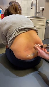 🏆 Cupping therapy on the low back helps lift tight fascia, increase circulation, and reduce deep muscle tension—especially after long hours sitting or lifting. 🏌🏽‍♂️🏋🏻‍♀️🏃🏾‍♂️ #CuppingTherapy #LowBackPain #ChicagoChiropractor | Dr_kyleross