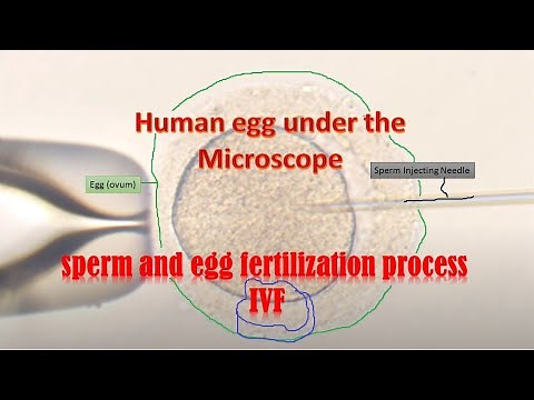 Human eggs under the Microscope during IVF fertilization