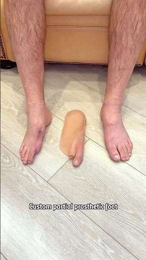 Partial Toe Amputee Gets a Hyper-Realistic Silicone Prosthetic Toe