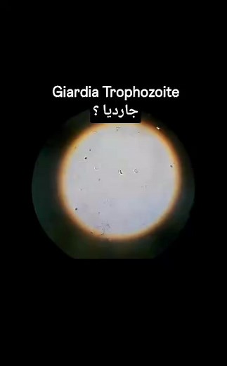 4K views · 15 reactions | #reelsvideoシ #explore | LAB Medical مختبرات طبية | Facebook