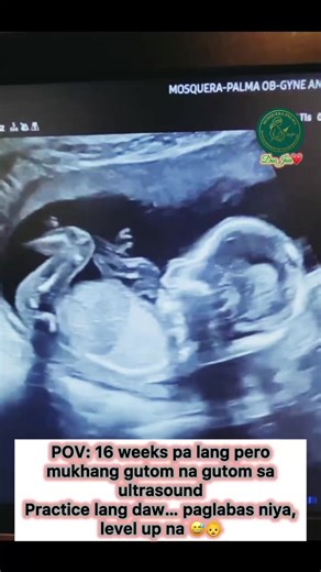 16 Weeks Ultrasound Baby Development Insights