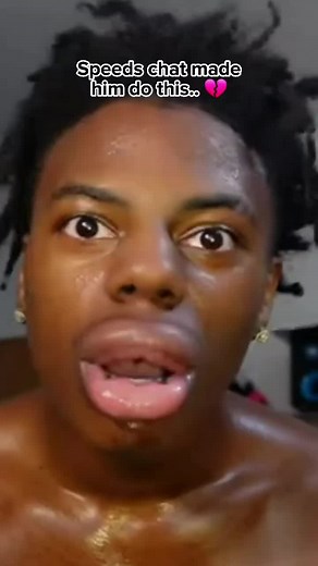 Ishow Speed Lips Transformation: The Unusual Journey