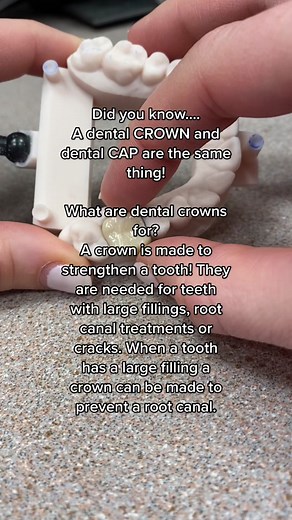 Dental Crown vs. Dental Cap: Know the Difference