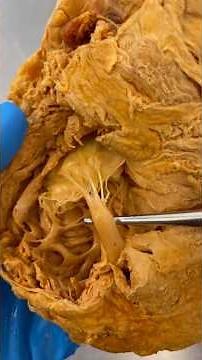 Real Human Heart Valve!