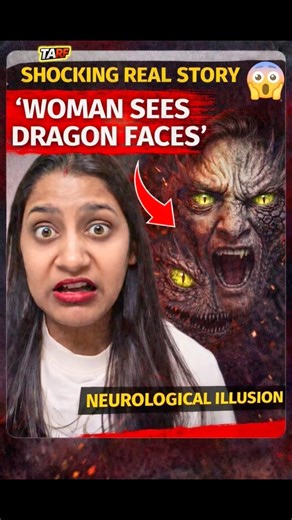 Why this Woman Sees Dragon Faces 😱 | Rare Brain Disorder Explained #shorts