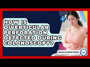 How Is Diverticular Perforation Detected During Colonoscopy? - Diverticulitis Support Network