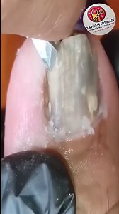 4.1K views · 22 reactions | Soft non-harsh practices for smoother nail upkeep  #gentlecare #dailybalance #wellnessmoves | Danish irshad fans | Facebook