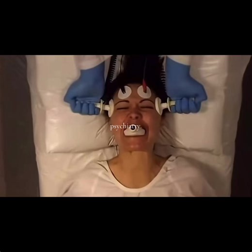 psychiatry is one of the most interesting subjects in my opinion — i should’ve added lobotomy #psychiatry #psychology #neuroscience #medicine #fyp