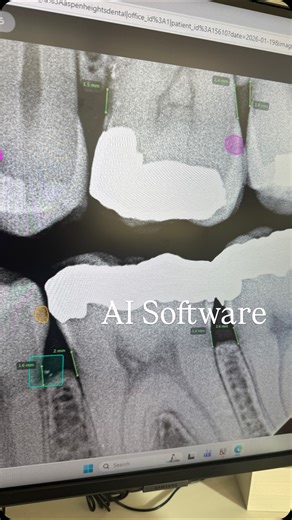 Hygiene Edge on Instagram: "Do you use any type of AI software in your practice? Are you loving it? Hating it? I’ve actually really liked using it because it’ll highlight areas that potentially could be missed. Is it perfect? No. The Pit had an amazing quote about AI talking about going with what your gut is telling you since that’s something AI will never have."