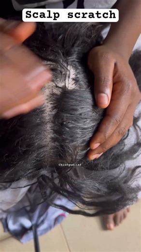 Scalp scratch. #asmrshorts #massageasmr #viral #fypシ