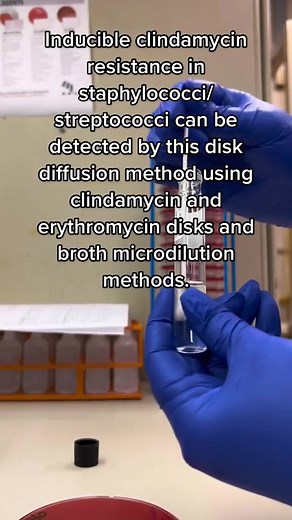 62K views · 843 reactions | Microbiology is fun ❣️ #lablife #microbiology | Lab life | Facebook
