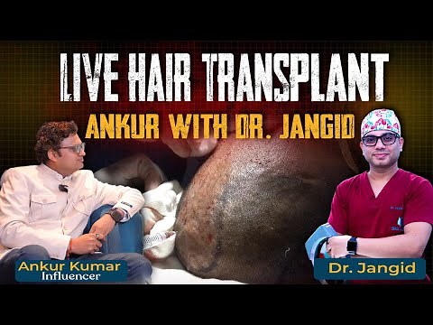 Hair Transplant Explained LIVE | Explained by Dr. Jangid | Delhi Best Clinic