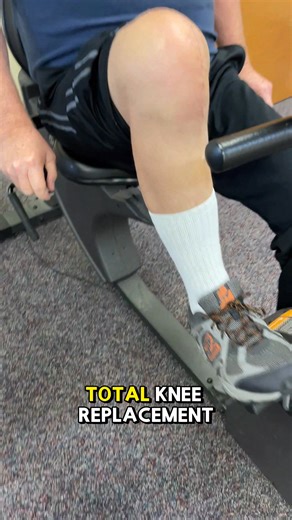This is amazing!!! This video was recorded on the first day of outpatient physical therapy. This patient was 3 weeks post op and just pedaling the recumbent bike like it was nothing!!! ... I can tell you that after seeing and talking to over 1,000 patients after knee replacement surgery I am still shocked on a regular basis. ... If you are looking for a great piece of home exercise equipment for your recovery and you don't have enough room for a recumbent bike like this I would recommend the Cub