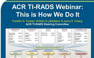 美国放射学会ACR关于甲状腺超声【TI-RADS分级】线上研讨会 Part I ：This Is How We Do It