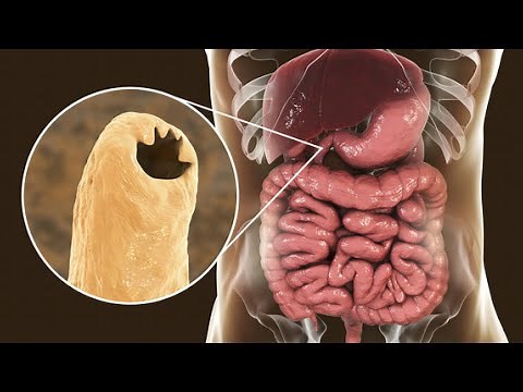Phylum Nematoda Part 2: The Parasitic Nematodes