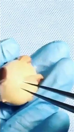 what the eye muscles responsible for its movement in different directions look #intraocular