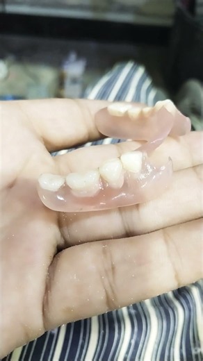 Flexible Lower Removable Partial Denture By Haider 😁😁😁#flexible#partialdenture#rpddentalprocedure