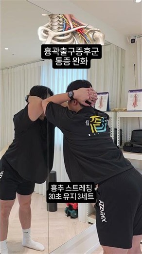 흉곽출구중후군 통증완화