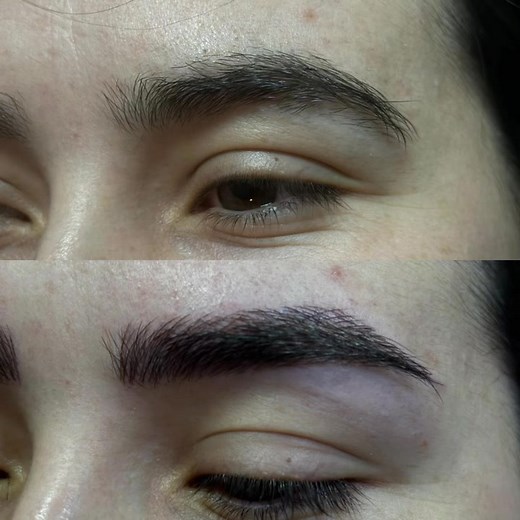 Microblading is a semi-permanent cosmetic procedure designed to enhance the appearance of eyebrows. It involves using a specialized manual tool with fine, hair-like needles to deposit pigment into the upper layers of the skin. The result is natural-looking, fuller, and more defined brows that mimic real eyebrow hairs. The procedure typically begins with a consultation and brow mapping to determine the ideal shape for the client’s facial features. After numbing the area, the technician creates de