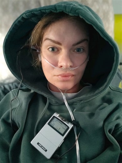 Meine Erfahrung mit hyperbarer Sauerstofftherapie bei ME/CFS... 14 Tage HBOT waren geplant, nach 5 Tagen mussten wir die Therapie jedoch abbrechen. Die ersten Tage in der Druckkammer ging es mir noch relativ gut. Außer starker Müdigkeit und schlechtem Schlaf habe ich keine starken Nebenwirkungen gespürt. Am 5. Tag kam dann der Crash und damit der Abbruch. Selbst wenn ich gewollt hätte, es ging nichts mehr. Es folgten eine Migräneattacke nach der anderen, mein POTS hat sich verschlimmert, mein oh