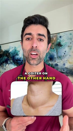Why Your Thyroid Can Enlarge