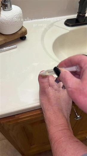 Effective Antifungal Treatments for Foot Fungus