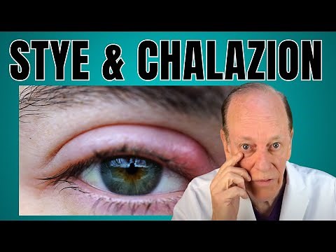 How a Plastic Surgeon Treats a Stye & Chalazion