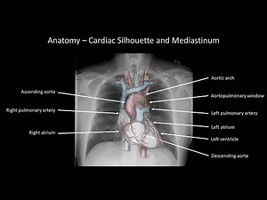How to Interpret a Chest X-Ray (Lesson 2 - A Systematic Method and Anatomy) • Video • MEDtube.net