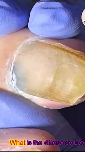 14K views · 84 reactions | Smart ways help men over 60 protect their aging feet #gentlehealth #safeathome #seniorhealth | Tots Mags Wheel | Facebook