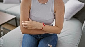 Young blonde woman scratching arm for itchy sitting on sofa at home