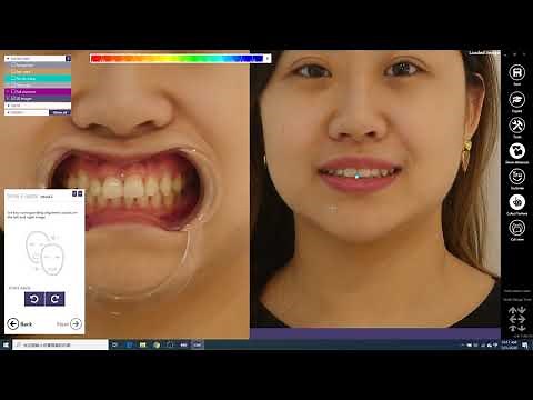 Digital Smile Design - Digital Dental Solutions