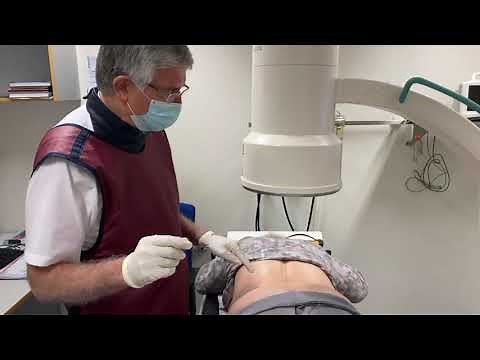 Ortho Daily Five (OD5) - Folge 10 - Facetteninfiltration