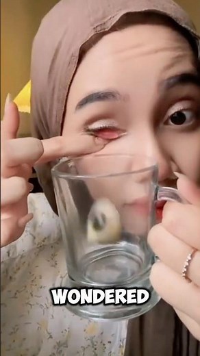 Do This If Something Is In Your Eye! 😱