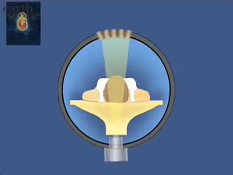 Computed Axial Tomography (CAT) Scan