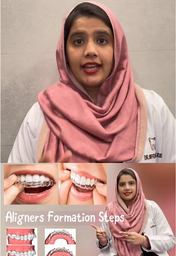 Steps required for Aligners formation and Procedures during Aligners treatment. #dentist #clinic #tiktok #awareness #trending #educational #aligner