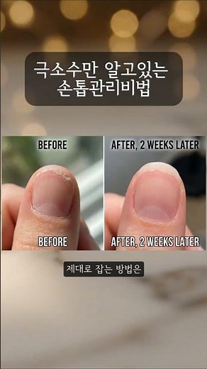 The Real Reason Your Nails Keep Breaking (A Care Tip Only a Few Know)