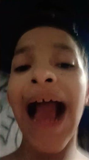 como apedra uma pedra🔥