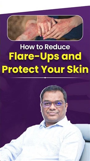 Why Does My Skin Keep Flare-Up? How Can I Prevent It? | Dr. Anand Hair & Skin