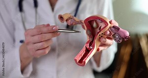 Gynecologist shows structure of uterus on model of uterus. Anatomy of female reproductive system and treatment of diseases