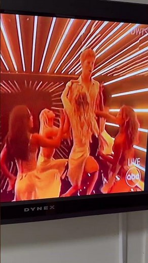 Robert Irwin Scores a Perfect 10 in “Freestyle” on the “Dancing with the Stars” Finale
