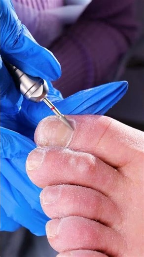 Ultimate Foot Spa: Transform Your Toes at Home! 🦶💖