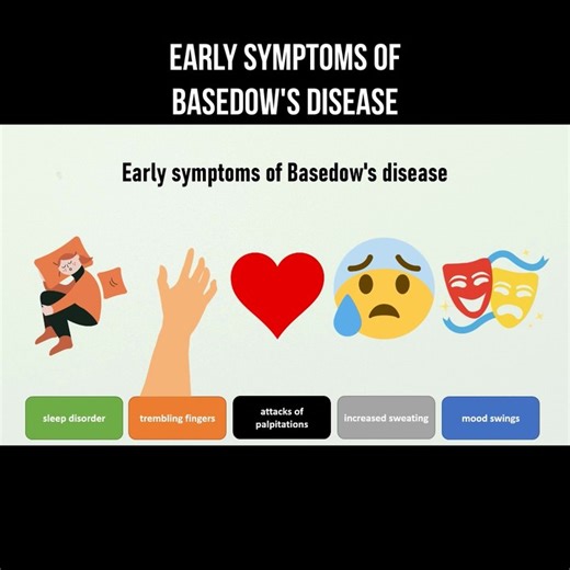Early symptoms of Basedow's disease